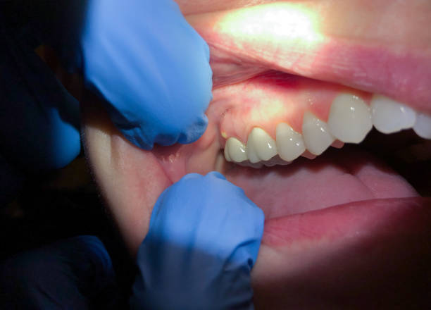 Best Pediatric Emergency Dentist in Clintwood, VA