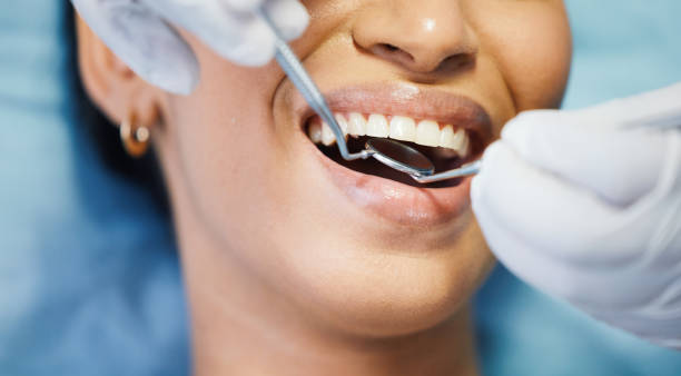 Best Emergency Dentist for Knocked-Out Tooth in Clintwood, VA